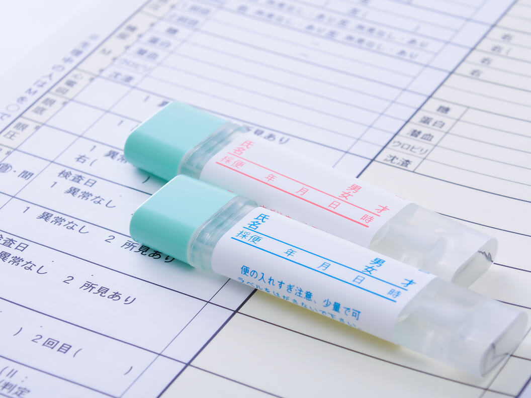 便潜血検査